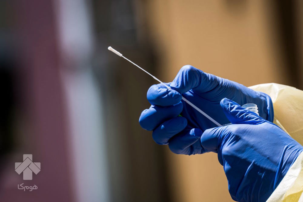 تست کرونا در منزل کرج