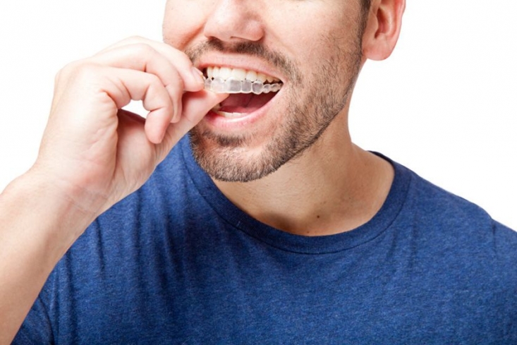 متخصص ارتودنسی کیست؟ و چه تفاوتی با دندانپزشک دارد؟ ارتودنسی یا Orthodontic با استفاده از روشهای مختلف، سعی میکند ناهنجاریها و مشکلات پیش آمده برای صورت، فک و دندانها را برطرف کند. متخصص ارتودنسی یا Orthodontist فردی است که دانش و مهارت لازم برای انجام این کار را کسب کرده است.