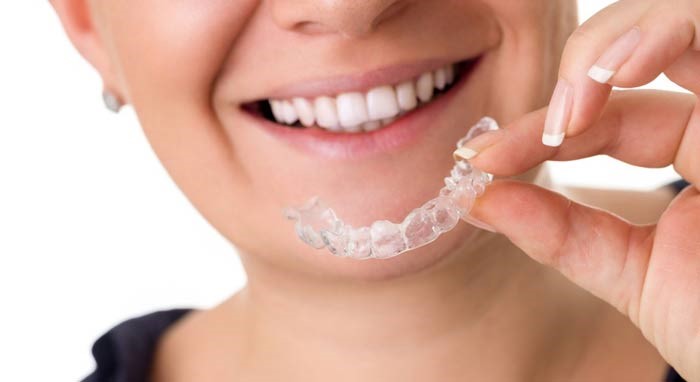 مدت زمان روش درمان ارتودنسی نامرئی (اینویزالاین) - دکتر داود عبدالهی