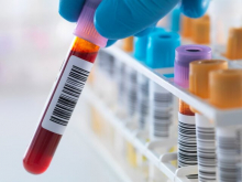متخصصان مرکز خدمات ملی بهداشت انگلیس (NHS) در گزارشی از احتمال دستیابی به نوعی آزمایش خون که می‌تواند ده‌ها نوع سرطان مختلف را تشخیص دهد، خبر دادند.