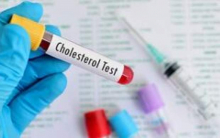 یک فوق تخصص غدد با بیان اینکه چربی خون بالا علائم بالینی زیادی ندارد، گفت: سکته قلبی و مغزی، تنگی عروق محیطی و فشار خون بالا علائم چربی خون بالاست که براثر چربی بالا به سراغ فرد می‌آیند.