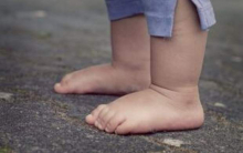  اگر جزو آن دسته افرادی هستید که کف پای شما صاف است، پیشنهاد می کنیم از همین حالا باورهای قدیمی را درباره مشکلات ناشی از صافی کف پا دور بریزید.