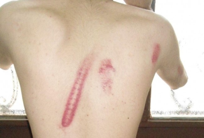 با توجه به فجایع روز گذشته در برخورد  گاز انبری با دانشجویان، بیش از همیشه چهره امنیتی دولت یازدهم برای افکار عمومی روشن شده است، دولتی که از شخص رییس جمهور تا دستیار ارشد او و حتی مشاور فرهنگی و وزیر کار و تعاون وی همگی سوابق امنیتی قابل ملاحظه ای دارند و از لطایف روزگار است که چنین مجموعه ای مدعی برخورد آزاد یا مدنی! با منتقدان بویژه دانشجویان شود، لذا اگر در چنین دولتی جز باتوم و بازداشت برخورد دیگری با دانشجویان و نخبگان کشور صورت بگیرد باید تعجب کرد!
