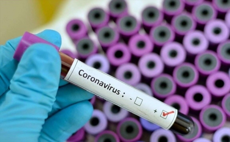 تعداد مبتلایان به ویروس کرونا در کشور به گفته سخنگوی وزارت بهداشت افزایش یافت.
